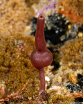 Heteropia
